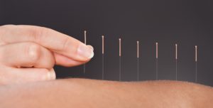 Acupuncture in chicago